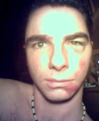 Bild(1)